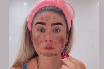 influencer heces en la cara.jpg